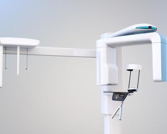 an example of a Cone Beam Scanner
