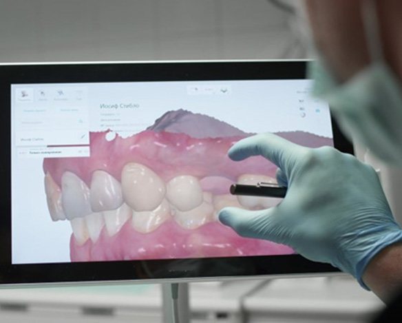 a dentist looking at a CBCT scan of teeth