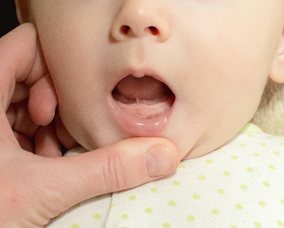A person pulling down on a baby’s lower lip to expose their gums and frenum located underneath the tongue