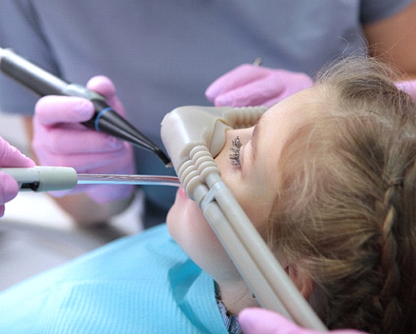 Girl undergoing nitrous oxide dental sedation in Coppell