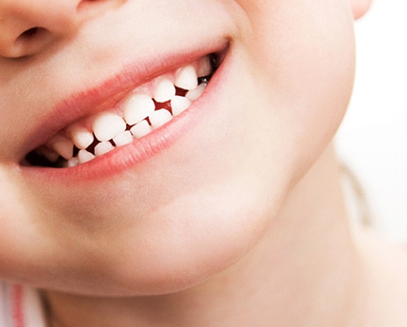 An up-close view of a young child’s smile, complete with their exposed top and bottom rows of teeth