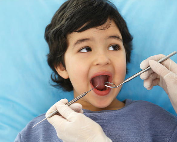Relaxed child receiving dental care thanks to nitrous oxide dental sedation